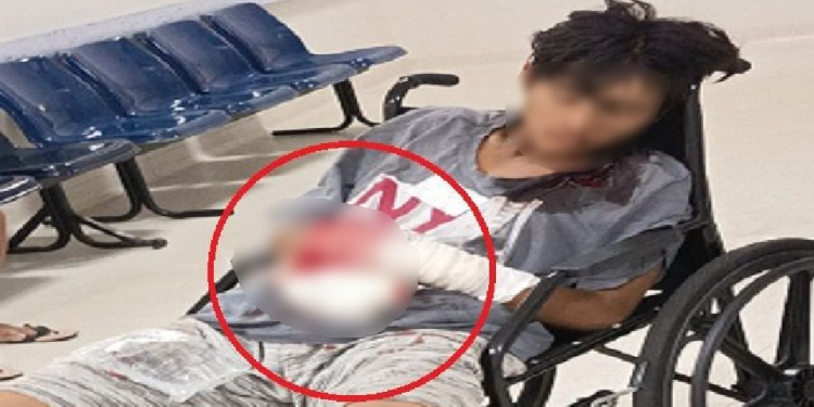 Jovem bal3ad0 nas mãos é abandonado em hospital de Manaus em possível ação do ‘Tribunal do cr1m3’