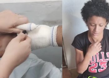 Vídeo: mulher do “pé podre” recebe curativos e cuidados especiais em Manaus