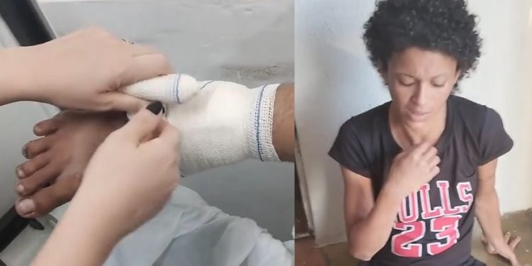 Vídeo: mulher do “pé podre” recebe curativos e cuidados especiais em Manaus