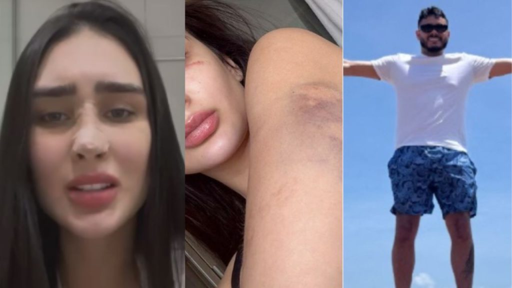 Miss Manaus diz ter reagido com faca após ser agredid4 e mantida em cárcere pelo namorado