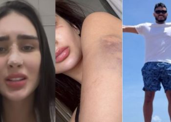 Miss Manaus diz ter reagido com faca após ser agredid4 e mantida em cárcere pelo namorado