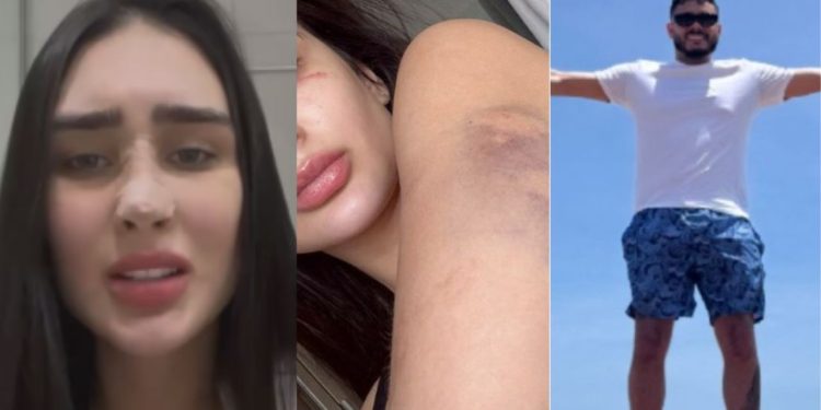 Miss Manaus diz ter reagido com faca após ser agredid4 e mantida em cárcere pelo namorado