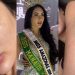 'Deu murros na cara’: Miss Manaus denuncia ex-companheiro e mostra marcas pelo corpo