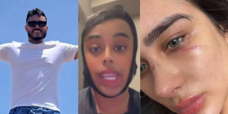 Vídeo: Blogueiro joga a culpa para Miss Manaus que foi agredid4 pelo ex: “estou defendendo agress0r”