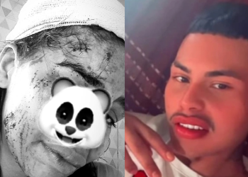 Vídeo: Jovem tem f3r1ment0s graves ao encontrar em adega homem que conheceu na internet em Manaus