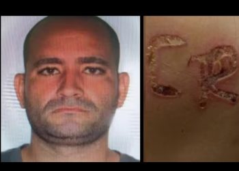 Homem usa ferro na brasa para cravar iniciais na esposa e acaba pego na Delegacia da Mulher