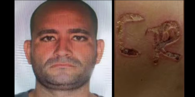 Homem usa ferro na brasa para cravar iniciais na esposa e acaba pego na Delegacia da Mulher