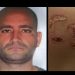 Homem usa ferro na brasa para cravar iniciais na esposa e acaba pego na Delegacia da Mulher