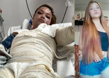 M0rte misteriosa em motel: Jovem mãe m0rre após sofrer que1maduras na banheira