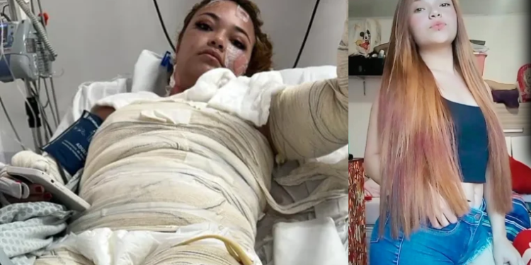 M0rte misteriosa em motel: Jovem mãe m0rre após sofrer que1maduras na banheira