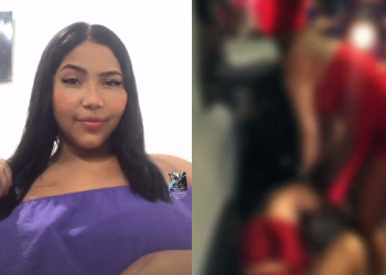 Jovem que ficou em c0ma após p0rrada em adega sai da UTI: ‘Saiu da entubação’