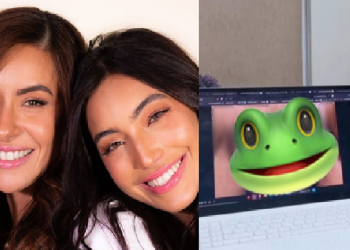 Mãe da ex-BBB Vanessa Lopes é criticada ao mostrar pele retirada na cirurgia da ‘preciosa’; veja