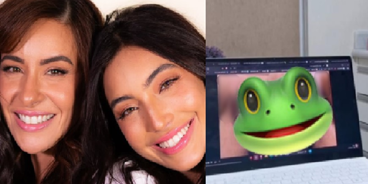Mãe da ex-BBB Vanessa Lopes é criticada ao mostrar pele retirada na cirurgia da ‘preciosa’; veja