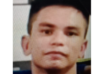 Polícia procura homem que causou lesã0 na cabeça da ex-companheira em Manaus