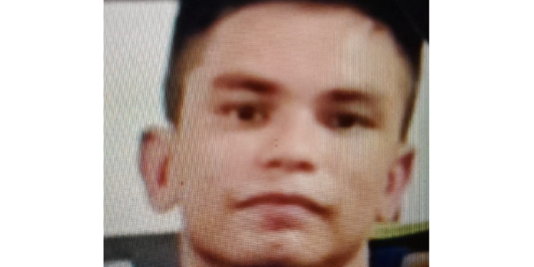 Polícia procura homem que causou lesã0 na cabeça da ex-companheira em Manaus