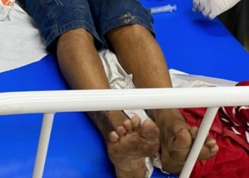 Jovem chega ferid0 ao hospital e diz que foi baleado pela Polícia Militar do Amazonas