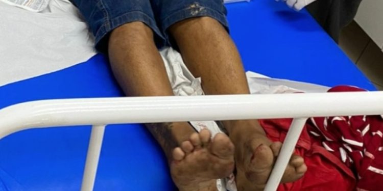 Jovem chega ferid0 ao hospital e diz que foi baleado pela Polícia Militar do Amazonas