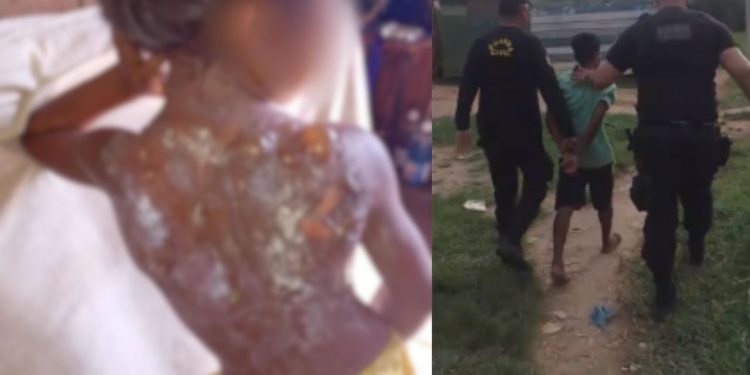 Vídeo: Padrasto joga mingau quente e queima costas de menina de 6 anos em Autazes