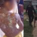 Vídeo: Padrasto joga mingau quente e queima costas de menina de 6 anos em Autazes