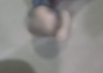 Pistoleir0s erram o alvo e atir4m no peito de garoto de 13 anos em Coari