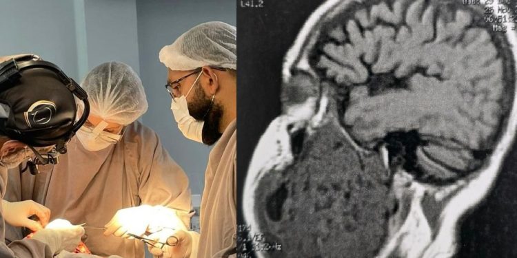 Homem retira tumor de 2 kg da mandíbula em Manaus
