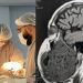 Homem retira tumor de 2 kg da mandíbula em Manaus