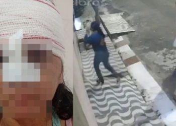 Vídeo: veja como ficou rosto de mulher que apanh0u com capacete de moto no Amazonas