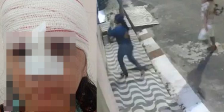 Vídeo: veja como ficou rosto de mulher que apanh0u com capacete de moto no Amazonas