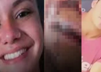 Veja como ficou desfigurad0 o rosto da mulher que levou 60 s0c0s do ex no elevador