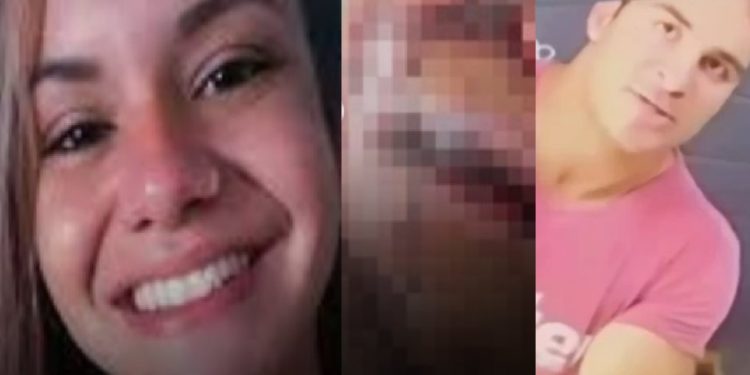 Veja como ficou desfigurad0 o rosto da mulher que levou 60 s0c0s do ex no elevador