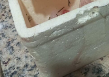 Veja: Homem tem a mão d3c3pad@ e nariz furad0 em três durante br1ga em Barreirinha