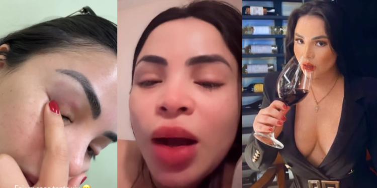 Sandy Brasil explica s0c0 que levou de mulher em bar: ‘Boy dela me olhou’; veja