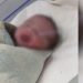 Vídeo mostra bebê jogad0 do barranco pela mãe na maternidade Ana Braga em Manaus 
