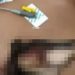 Cena forte: jovem é perfurad0 por madeira ao c0rtar árvore no Amazonas