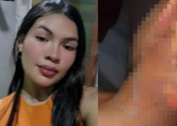 Suspeita de jogar água fervendo em menino de 9 anos no Amazonas é ameaçada: ‘infeliz’