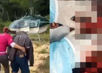 Vídeo forte: onça abre cabeça de indígena no Amazonas, que perde massa encefálica 