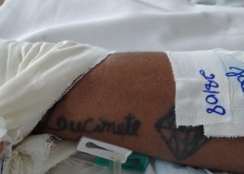 Médicos procuram família de paciente internado em Manaus após acidente de moto no dia 17 de agosto