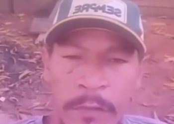 Vídeo: paciente da UPA com “cenoura no fi0fó” se explica: ‘a dor foi tão grande’