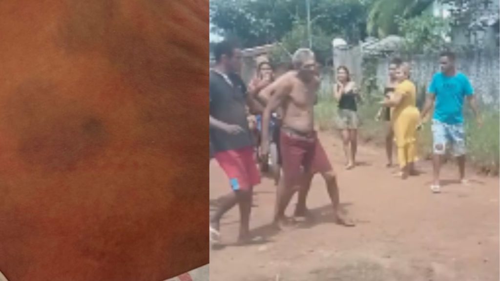 Pai é preso por deixar a filha de apenas cinco dias de vida cheia de hemat0mas; veja