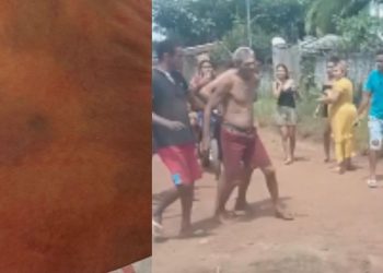 Pai é preso por deixar a filha de apenas cinco dias de vida cheia de hemat0mas; veja