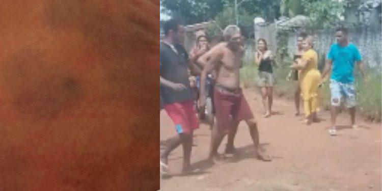 Pai é preso por deixar a filha de apenas cinco dias de vida cheia de hemat0mas; veja