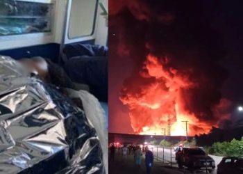 Grávida vítima de incêndio passa por cirurgia após ter 44% do corpo queimado