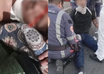 Linha de cerol c0rt4 pescoço de motociclista em Manaus; vítima pede mais segurança