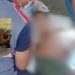 Pastor alemão avança em menino de 10 anos e provoca feriment0s graves no interior do AM