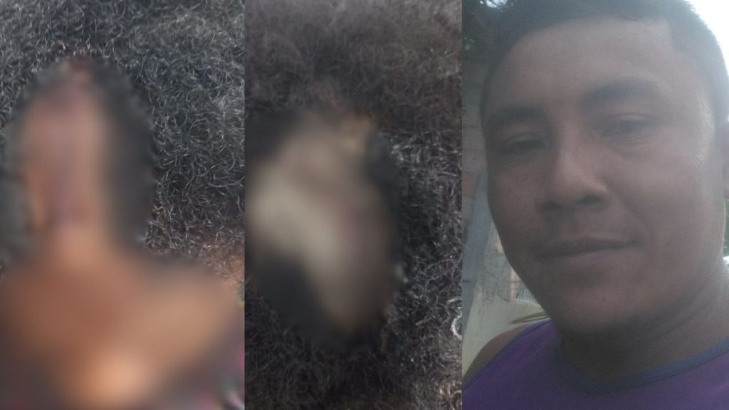 Marido agr1de esposa com remo e a deixa gr4vemente fer1da no Amazonas