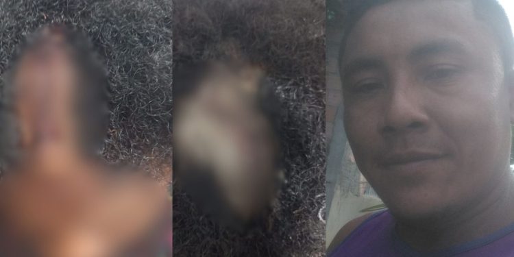 Marido agr1de esposa com remo e a deixa gr4vemente fer1da no Amazonas