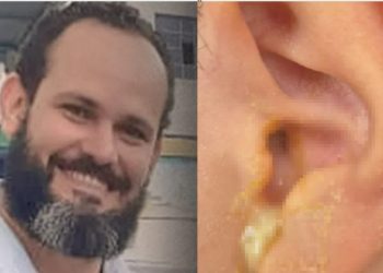 IML de Manaus confirma: tapa de oficial que fur0u tímpano de menino de 8 anos pode deixá-lo surdo