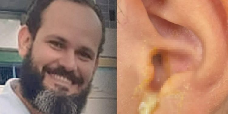 IML de Manaus confirma: tapa de oficial que fur0u tímpano de menino de 8 anos pode deixá-lo surdo