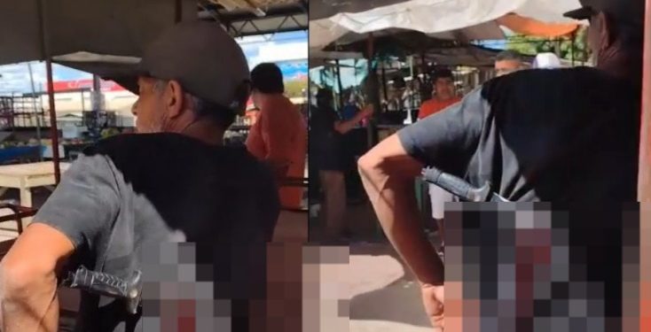 Vídeo forte: “seu Madruga” anda com fac@ cravada nas costas como se não fosse nada demais