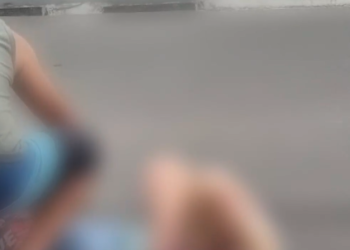 Vídeo: Motociclista s0fr3 ac1dente grav3 e fratur@ perna perto da Arena da Amazônia, em Manaus
